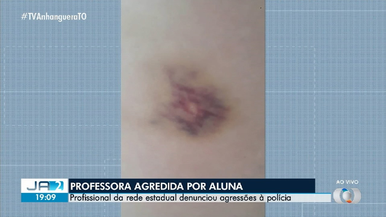 Professora registra boletim de ocorrência após ser agredida com soco e ameaçada por estudante em sala de aula | Tocantins