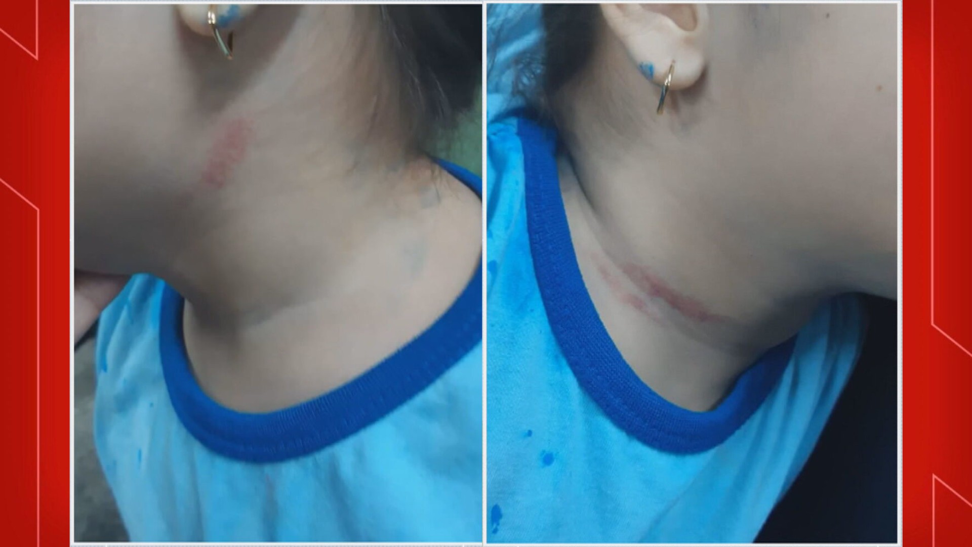 Beliscão, arranhões e ameaças: famílias denunciam agressões por professores em escolas públicas do DF