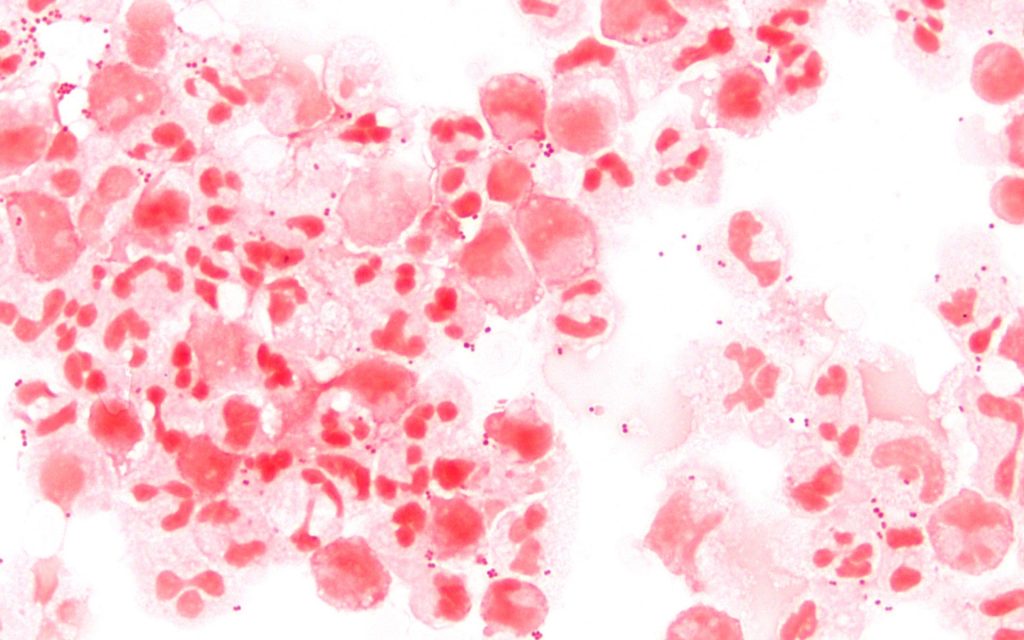 neisseria-meningitidis-csf-gram-1000.jpg